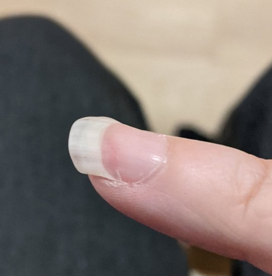 My cracked and abused fingernail